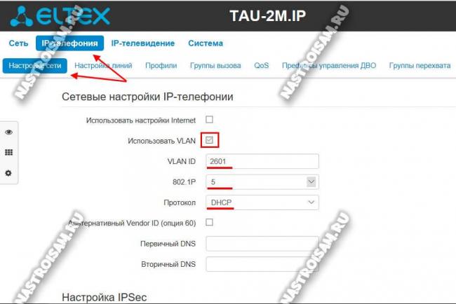 tau-2-vlan.jpg