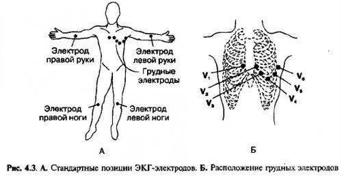 delajut-ekg-1-500x257.jpg