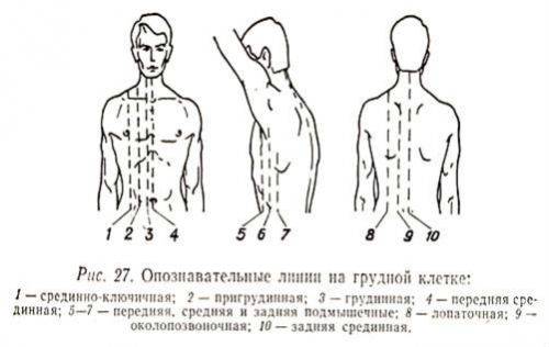 delajut-ekg-2-500x316.jpg