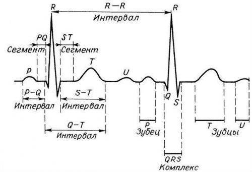 delajut-ekg-3-500x341.jpg